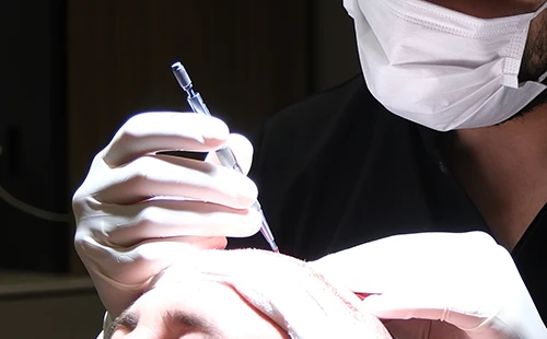 痛みに配慮した局所麻酔・静脈鎮静などの選択肢